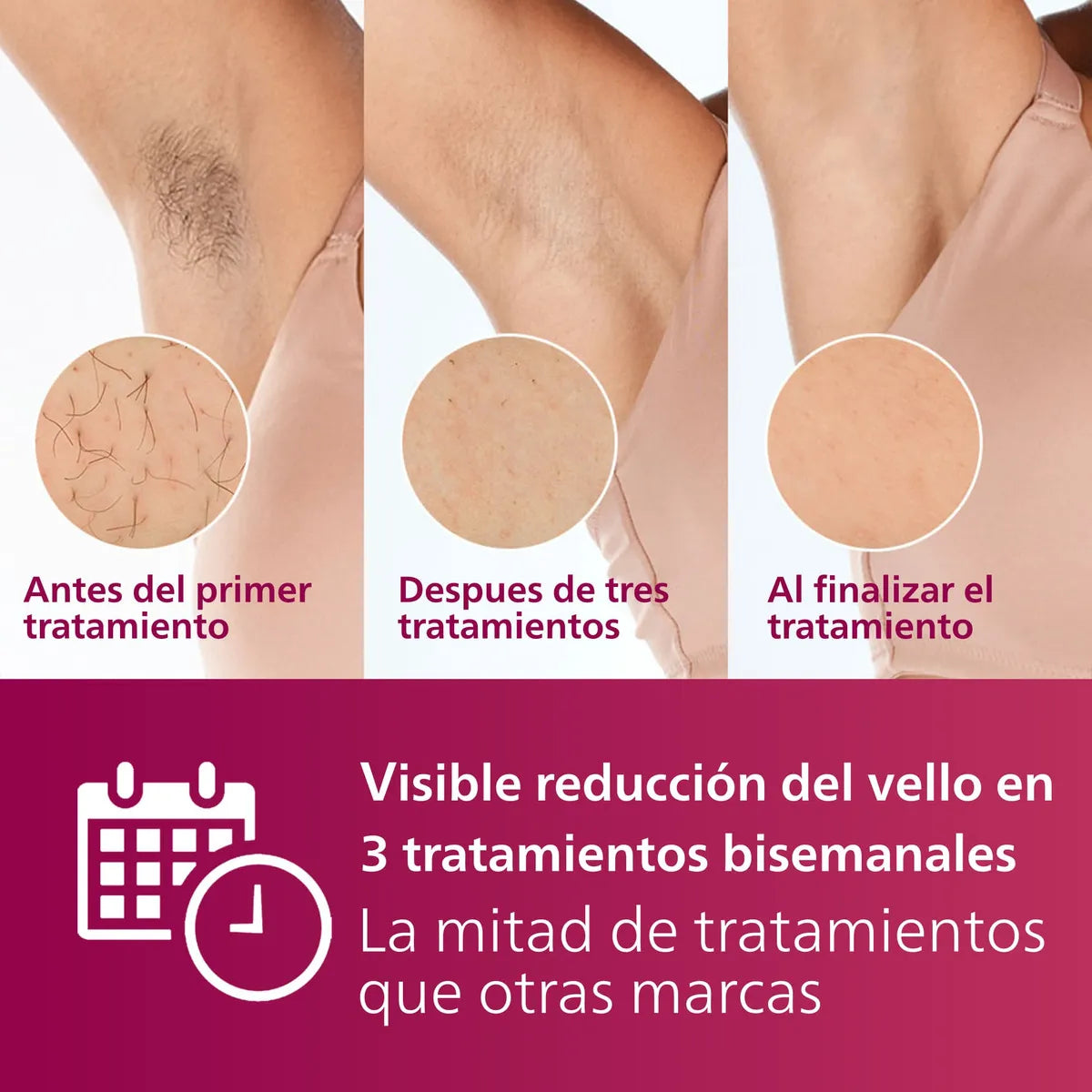 DEPILADORA LASER PHILIPS LUMEA IPL HAIR REMOVAL 7000 BLANCO