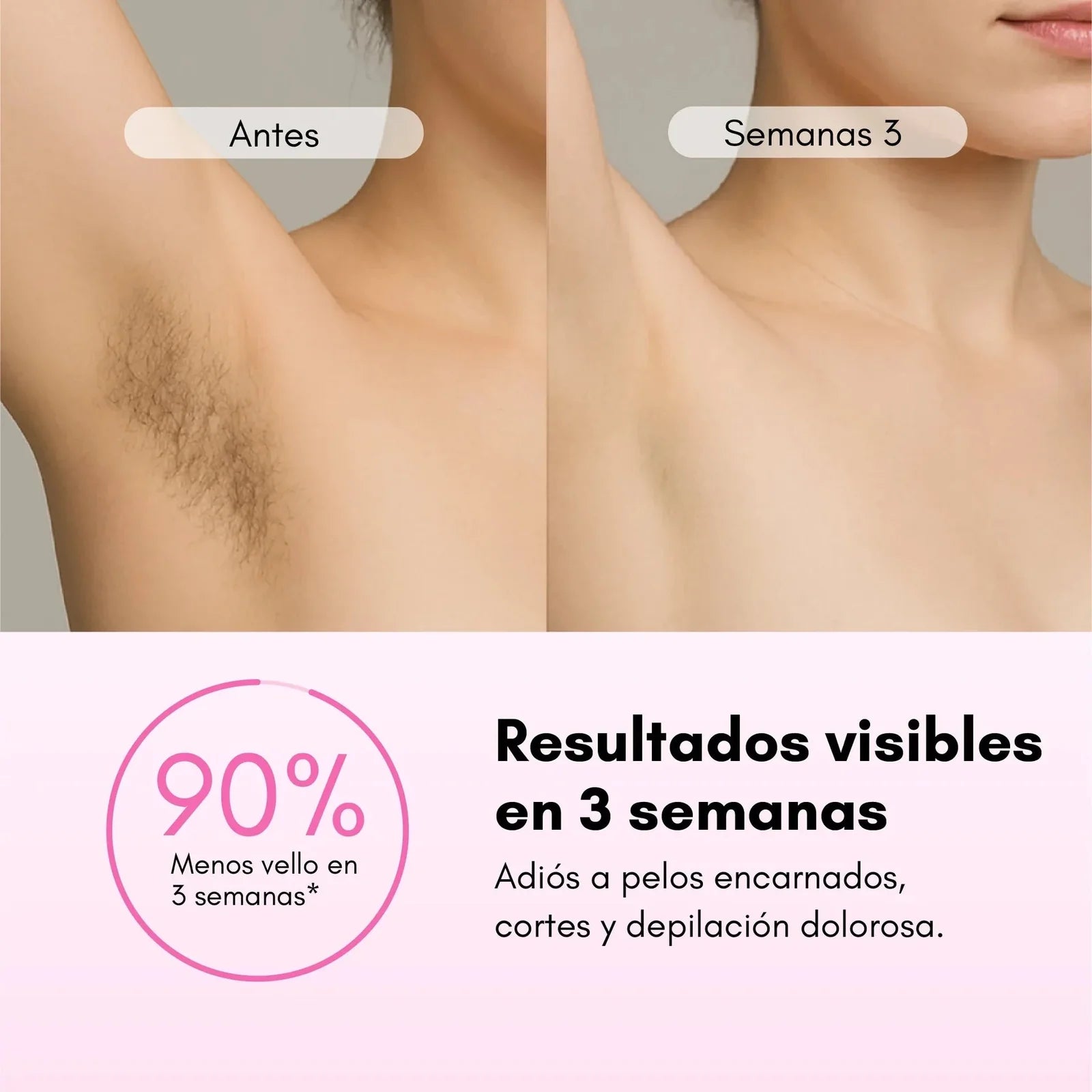 Depiladora Láser Rebel Skin 1